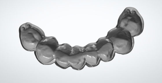 خرید طراحي دنداني CAD CAM برای ایمپلنت پل موقت PMMA تولید آنلاین