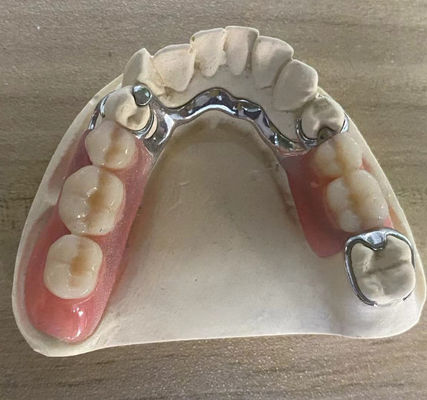 خرید قاب فلزی نقره ای قابل اعتماد مقاومت در برابر خوردگی با طراحی سفارشی تولید آنلاین