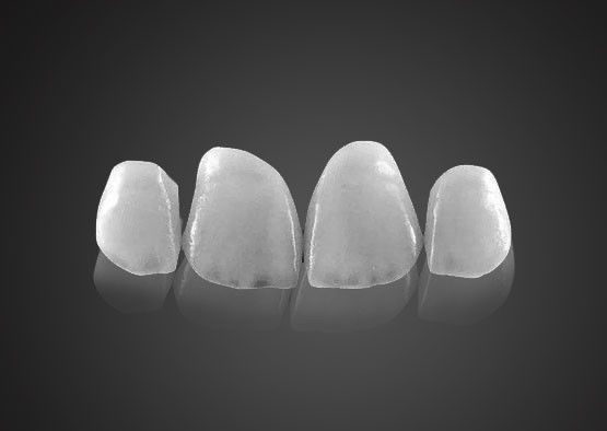 IPS 0.2mm Ultra Thin Emax Veneers مقاوم به لکه با قدرت بالا