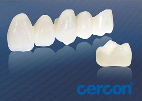مقاومت در برابر پوشیدن CAM Cercon Zirconia تاج های آسان تمیز کردن سازگاری زیستی بالا