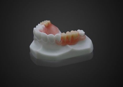 سبک وزن راحت Valplast دندان مصنوعی جزئی آسان تمیز کردن شفافیت بالا